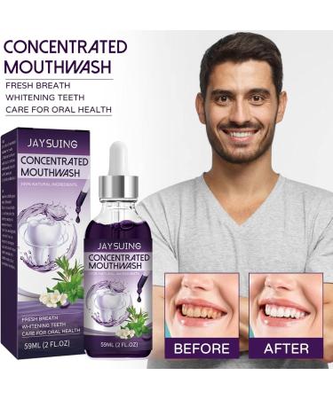 Ailopta Mouthwash for Bad Breath | 59ml Cool Mint Alcohol-Free No Dyes or Sweeteners - Buy Online on GoSupps.com