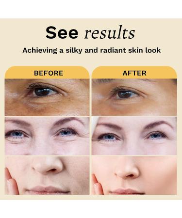 ANAI RUI Turmeric Oil - Dark Spot Treatment & Moisturizing Facial Serum 1.06oz - Buy Online on GoSupps.com