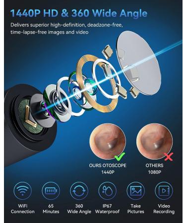 TopWigy Ear Wax Removal Tool with 1440P Camera, 6 LED Lights & 6 Spoons - Waterproof 5MP HD Ear Otoscope for iOS & Android - Black - Buy Online on GoSupps.com