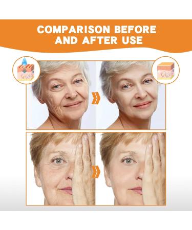 New Instant Skin Essence Collagen Set Spiral Peptide Deer Bone Collagen Essence Kit Reduces Fine Lines and Wrinkles Moisturizes Firms Skin Restores Elasticity (1set) - Buy Online on GoSupps.com