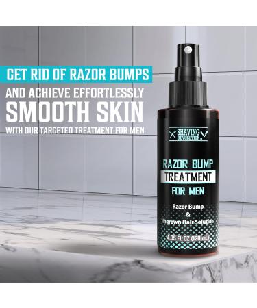 Viking Revolution Razor Bumps Treatment for Men | Ingrown Hair Removal & After Shave Serum with Salicylic Acid | Effective Razor Burn Solution | 1 Pack - Buy Online on GoSupps.com