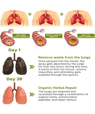 GFOUK BreathDetox Herbal Lung Cleansing Spray | Natural Respiratory Health Essence for Lung Detox - Buy Online on GoSupps.com