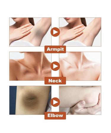 TRIMADE Acantho Clear Therapy Spray - Dark Spot Remover & Skin Lightening Treatment - Buy Online on GoSupps.com