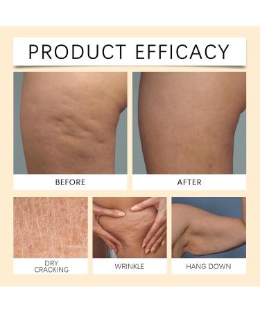  HNYXEQJL Set of 4 skin treatment creams: moisturizing cream to remove dead skin cells firming serum for the whole body deep-acting moisturizing and wrinkle-reducing - Buy Online on GoSupps.com