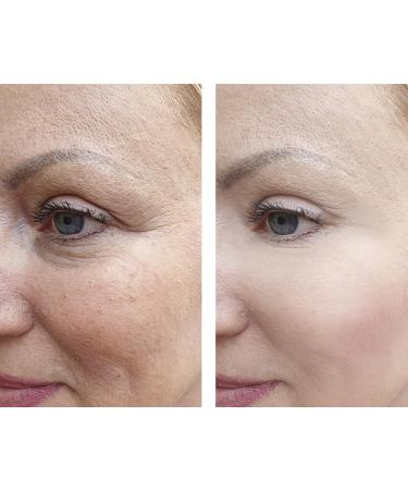 Buy Vitality Precision Skin Phloretin C Serum | Best Anti-Aging Formula for Radiant Skin - International Shipping Available - Buy Online on GoSupps.com