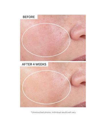 StriVectin Advanced Retinol Serum & Moisturizer for Fine Lines - 1.1 oz - Buy Online on GoSupps.com