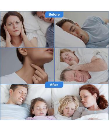 120 Pcs Advanced Gentle Mouth Tape for Nose Breathing | Stop Snoring and Mouth Breathing During Sleep - Buy Online on GoSupps.com