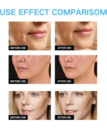 Vitamin C Hydrating Serum - Vitamin C Serum for Face - Anti-Ageing Face Serum for Women - Vitamin C Serum with Hyaluronic Acid - Skin Care - Vitamin C Serum Face - Restore & Boost Collagen Face Serum - Buy Online on GoSupps.com