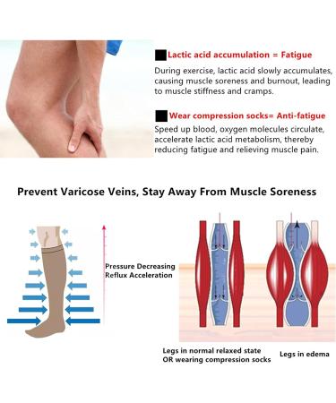 Compression Stockings for Men & Women - 20-25 mmHg Knee Socks for Sports Edema Varicose Veins Travel & Pregnancy - Black - Buy Online on GoSupps.com