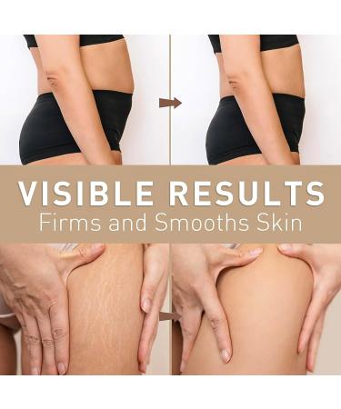 Bee Venom Skin Firming Body Cream Skin Tightening Cream Body Bees Firming Moisturizing Cream Cellulite Cream For Firmer & Recovered Skin Luxury Bee Venom Slimming Cream Natural Bee Venom Cream - Buy Online on GoSupps.com