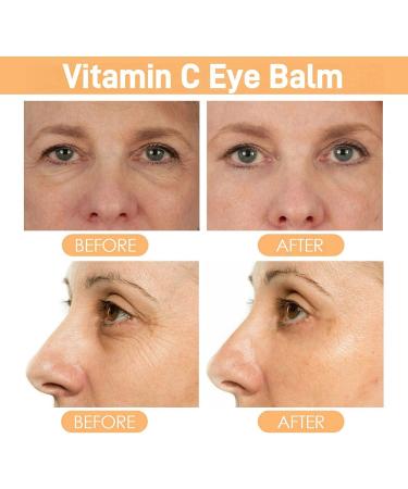Vitamin C Eye Cream Stick Brighten Vitamin C Eye Balm Moisturised Glow Eye Care Stick Anti Wrinkle Eye Cream Stick for Puffy Eyes Cooling & Hydrating Eye Cream Moisturizer Stick Eye Cream Anti Aging - Buy Online on GoSupps.com