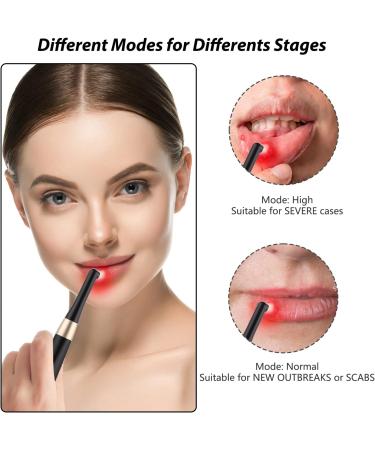 Cold Sore Red Light Device - Reusable Canker Sore Treatment for Pain Relief and Oral Care - Reduce Pain, Rejuvenate Skin - Black - Buy Online on GoSupps.com