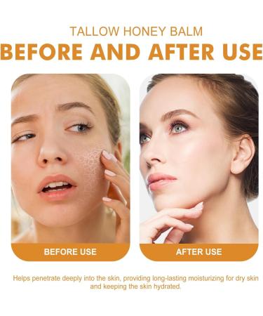 Tallow Honey Balm Tallow Moisturizer Firming Face Cream Tallow Face Cream Tallow Balm Instant Wrinkle Remover Tallow And Honey Balm Repair Barrier Face & Body Moisturiser For Dry Skin 30g - Buy Online on GoSupps.com