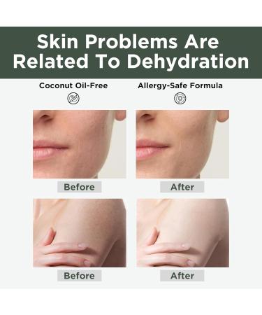 THESKCARE 100% Natural Honey Tallow Balm Multi-Purpose Honey & Grass-Fed Tallow Balm Deep Hydration for Dry Skin Cracked Hands All-Natural No Preservatives or Additives - Buy Online on GoSupps.com