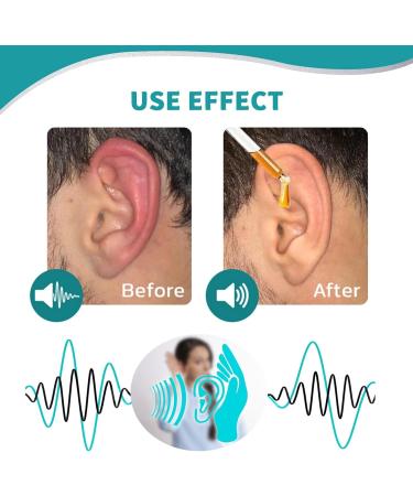 Tinnitus Relief Ear Drops - Natural Ear Oil for Ear Ringing and Itchy Ears - Buy Online on GoSupps.com