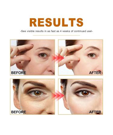 Pedia Advanced Collagen Boost Anti-Aging Serum - Hyaluronic Acid & Vitamin C for All Skin Types - 2 Pack - Buy Online on GoSupps.com