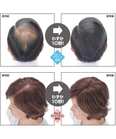 Super Million Hair Trial Set Hair Enhancement Fibers & Hard Mist (Medium Brown) by Super Million Hair - Buy Online on GoSupps.com