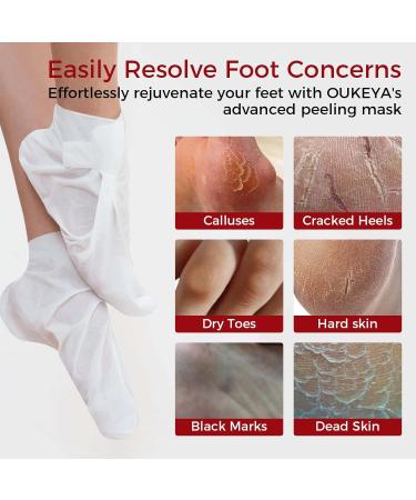 OUKEYA Foot Mask 3 Pairs: Nourish Foot Mask Dermatologically Tested Repairs Heels & Soften Dry Dead Skin for Cracked Feet(No Peeling) Rose - Buy Online on GoSupps.com