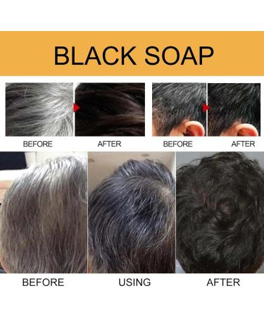  Orgrul 5PC Shampoo Bar for Shiny Gray Hair Hair Soap Against Gray Hair Revitalizing Natural Hair Darkening Shampoo Bar Solid Shampoo Bar Shampoo Bar for Anti-Gray Hair - Buy Online on GoSupps.com