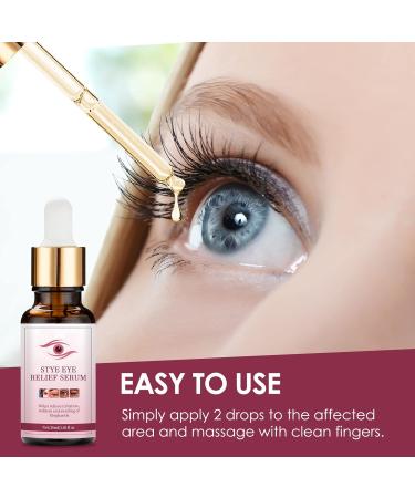 Stye Eye Treatment Chalazion Remover - Fast Relief Serum for Eye Irritation and Eyelid Relief - Buy Online on GoSupps.com