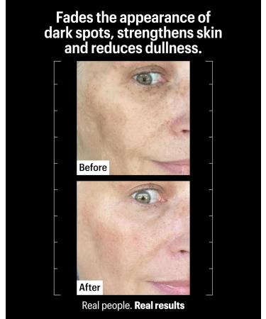 Allies of Skin Tranexamic & Arbutin Advanced Brightening Serum - Buy Online on GoSupps.com