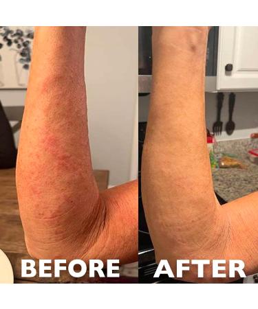 Hey Honey Skincare 911 Multipurpose Healing Ointment for Burns & Irritated Skin Instant Relief | Organic Propolis & Honey Extracts | Designed To Treat & Repair Compromised Skin 99% Natural | 1 Oz - Buy Online on GoSupps.com