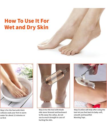 Foot File Professional Pedicure Stainless Steel Detachable Foot Scrubber Callus Remover for feet Foot Scraper Corns Callous Hard Skin Removers Pedicure Rasp for Wet and Dry Feet(Golden) - Buy Online on GoSupps.com