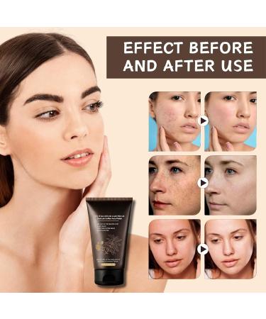 Natural Coffee Face Scrub Exfoliator Coffee Face Exfoliator Coffee Facial Scrub Face Exfoliator Scrub Face Scrub Exfoliates Dead Skin Cells Reduces Inflammation For Softer & Smoother Skin 60ml - Buy Online on GoSupps.com