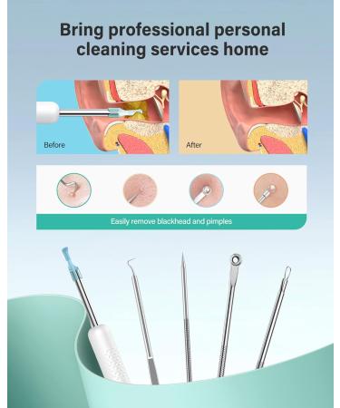 Xlife Wireless Ear Camera & Earwax Remover with 1080P HD, Blackhead Remover Kit - iPhone, iPad, Android - R1 White - Buy Online on GoSupps.com
