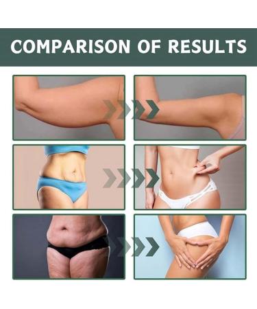 Firming Body Oil Body Shines Oil Body Oil Skin Care Body Oil Shiny Body Oil Shimmer Body Oil Body Oil for Wrinkles and Stretch Marks Lifting and Firming Body Oil Moisturiser Lifting Body Oil - Buy Online on GoSupps.com