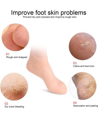 Buy Angrek Anti-Cracking Socks - 2 Pairs Moisturizing Foot Care Socks for Soft Heels (Size S 33-35) - Elastic Foot Protection - Buy Online on GoSupps.com