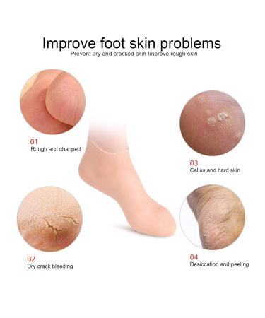 Elastic Foot Care Socks - Moisture-Wicking SEBS Material (2 Pairs XL 42-44) | International Shipping Available - Buy Online on GoSupps.com