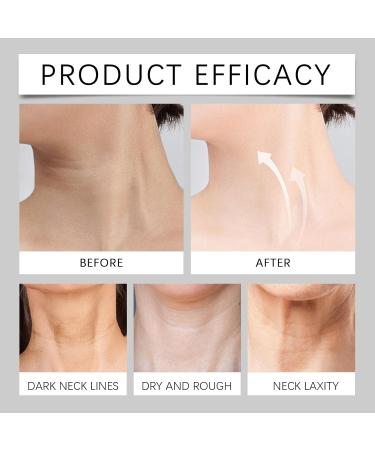 JOYVOIDX Hydrating Neck Cream with Massage Wheel Soothing Formula with Hyaluronic Acid & Centella Asiatica to Relieve Tightness Improve Elasticity and Provide Anti-Aging Care 4.23oz - Buy Online on GoSupps.com