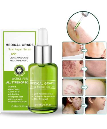 Advanced Scar Repair Serum - Medical Grade Treatment for All Types of Scars - 3PCS Set - Buy Online on GoSupps.com