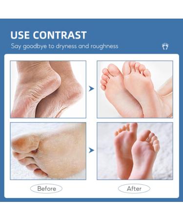 60% Urea Cream - Cracked Heel Repair Cream For Feet and Hand - Foot Cream for Cracked Heels and Dry Skin - Urea Cream 60 Percent for Feet - Maximum Strength for Hand Foot and Body Care - Buy Online on GoSupps.com