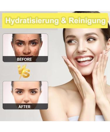  MEITREND Tourmeric Kojic Acid Lemon Turmeric Soap for Removing Dark Spots from Face and Body Turmeric and Kojic Acid Soap Lemon Shine Soap - Cleanser - 2 Pack - Buy Online on GoSupps.com