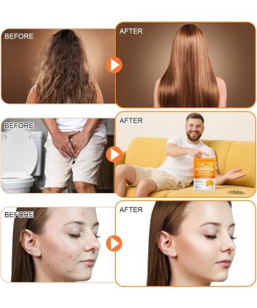 GTZSXNP Pumpkin Seed Oil Capsules 2 in 1 Pumpkin Seed Oil with Saw Palmetto Supplements Supports Hair Growth Bladder & Prostate Health | Non-GMO - Buy Online on GoSupps.com