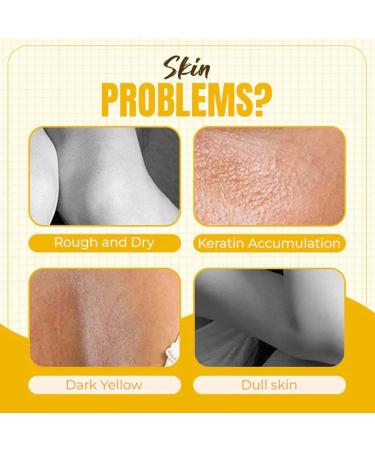 Thai Whitening Yellow Peeling Oil Super Powerful Peeling Natural Spots Whitening Yellow Peeling Oil with Hyaluronic Acid Softening Callus Removal - Buy Online on GoSupps.com