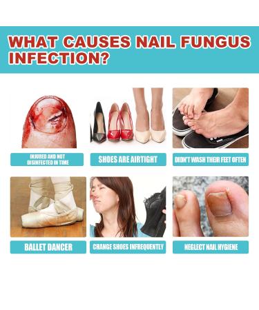 Toe Nail Patches for Fungus - Fast & Effective Nighttime Renewal | 16 Safe Fungal Nail Patches for Ultimate Foot Care - Buy Online on GoSupps.com
