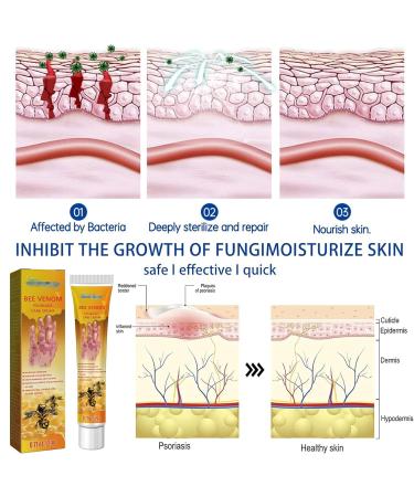 Beeergift Salbe Cream for Psoriasis | Professional Bee Venom Skin Repair | Soothing Care & Itch Relief - 2 Pieces - Buy Online on GoSupps.com