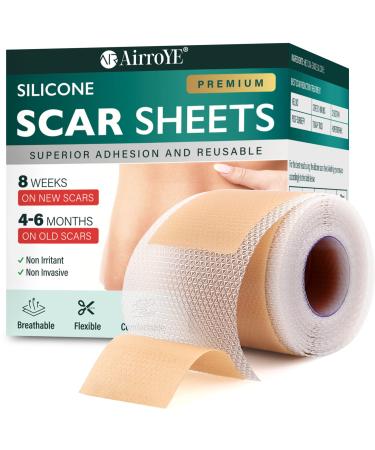 Silicone Scar Sheets Silicone Scar Tape(1.6"x 120" Roll-3M) Reusable and Effective Scar Removal Sheets Silicone Scar Removal Sheets for Surgical Scars Healing Keloid C-Section Tummy Tuck
