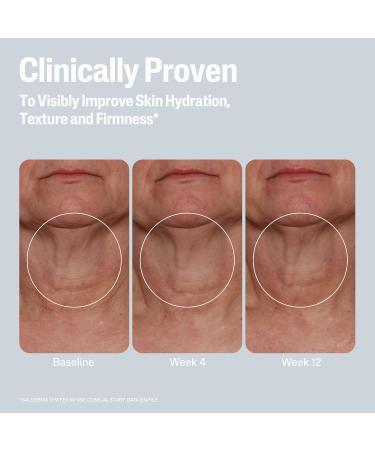 Cetaphil Skin Activator Hydrating & Firming Body Cream 12oz Mandelic Acid (AHA) and Centella Asiatica (CICA) Cream Hydrates and Firms Aging Skin Anti-Aging Skincare 12 oz 12 Ounce (Pack of 1) - Buy Online on GoSupps.com