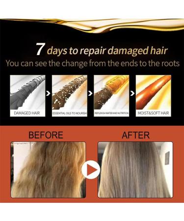 Ginger Hair Growth Serum - Anti Hair Loss Treatment for Men & Women - Buy Online on GoSupps.com