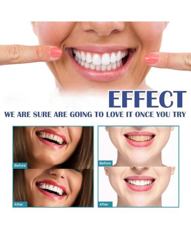 Gum Instant Teeth Repair Gel oral cleaning gel Soothing oral care for teeth and gums targeted application immediate relief for men and women 4 ml 2 Pieces - Buy Online on GoSupps.com