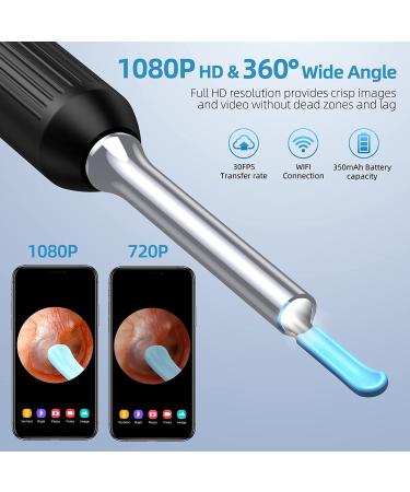 Ear Wax Removal Tool - 1080P Ear Cleaner Camera - 8 Pcs Kit - Otoscope with Light - Ear Wax Remover for iPhone, iPad, Android - Black - Buy Online on GoSupps.com