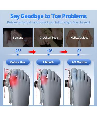 Bunion Corrector for Men & Women | Adjustable Bunion Splint for Pain Relief | Orthopedic Toe Straightener with Anti-Slip Heel Strap | Fits Left & Right Feet - Grey - Buy Online on GoSupps.com