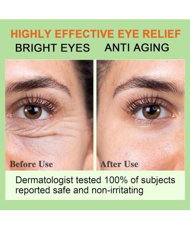 Vitality-Fill Eye Cream | Natural Anti-Aging Treatment for Dark Circles & Wrinkles | 0.5oz Organic Under Eye Cream - Buy Online on GoSupps.com