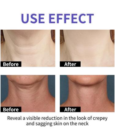 Tighten And Lift Neck Cream 2024 New Pure Neck Firming Cream Neck Cream for Tightening and Firming Go Anti-Aging Neck Cream Eliminates Wrinkles Repairs Firming 1 - Buy Online on GoSupps.com