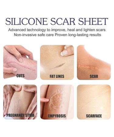 Silicone Scar Tape Roll - Easy-Tear Gel Tape for Surgery Scars - 1.6 x 120 Inch - Medical Grade Silicone Sheets - Wound Dressing for Scar Management - Buy Online on GoSupps.com