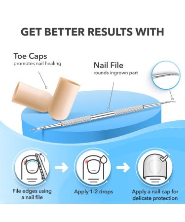 Dr. Krause Ingrown Toenail Treatment Kit - Gel Toe Caps, File, Pain Reliever, Softener - Tea Tree Oil Drops - Buy Online on GoSupps.com